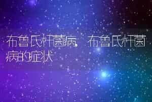 布鲁氏杆菌病，布鲁氏杆菌病的症状